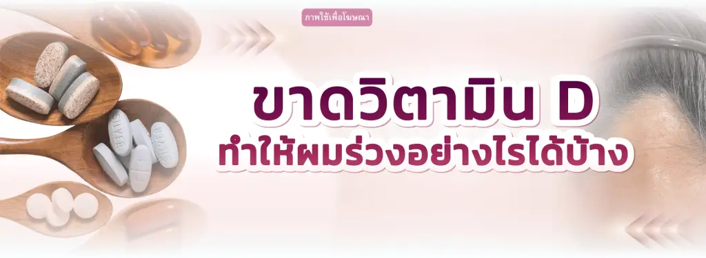 ขาดวิตามินดีทำให้ผมร่วง สาเหตุและวิธีแก้ | Wellnis