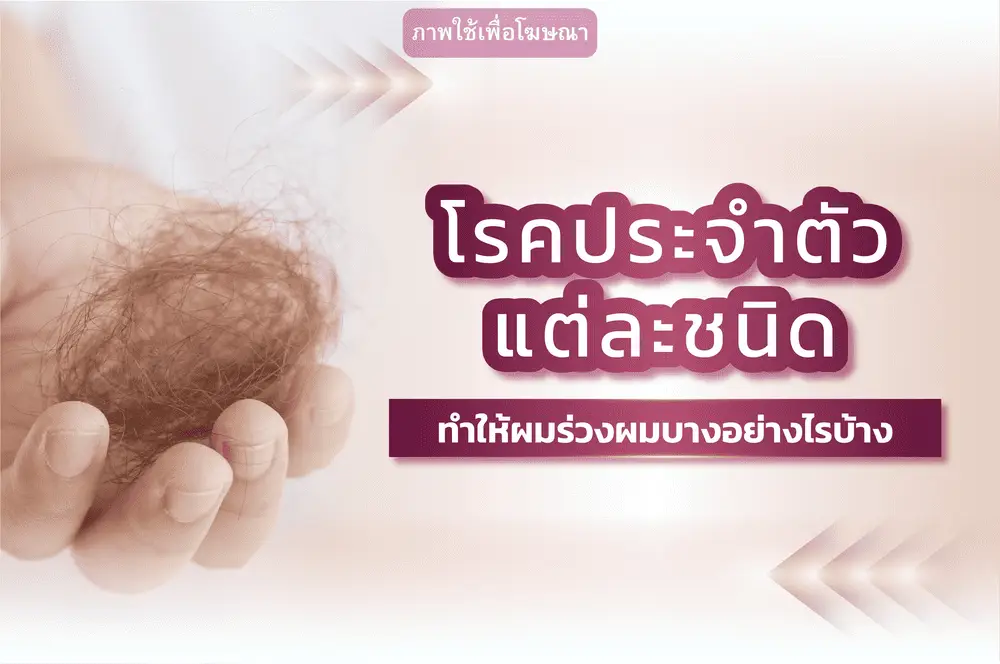 โรคประจำตัวทำให้ผมร่วง มีโรคอะไรบ้าง พร้อมวิธีดูแล | Wellnis