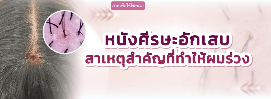 หนังศีรษะอักเสบทำให้ผมร่วง สาเหตุ อาการ วิธีดูแล | Wellnis