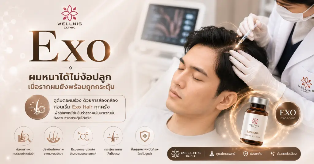 Exo Hair03