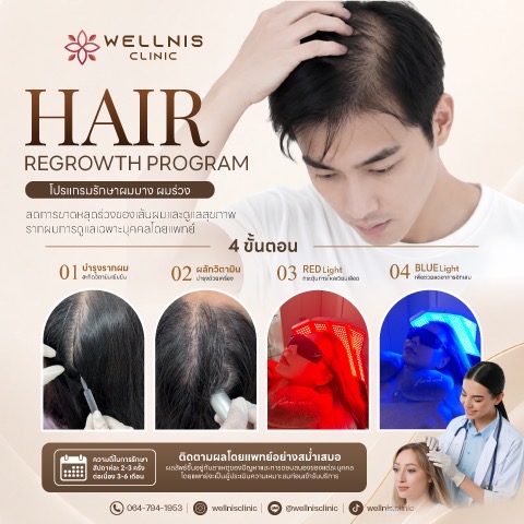 Hair Regrowth Program